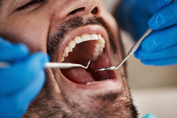 Best Urgent Tooth Repair  in Mount Carmel, OH